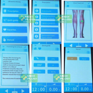 máy siêu âm trị liệu