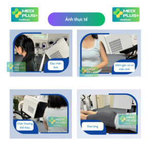 Máy Terahertz trị liệu MPZ